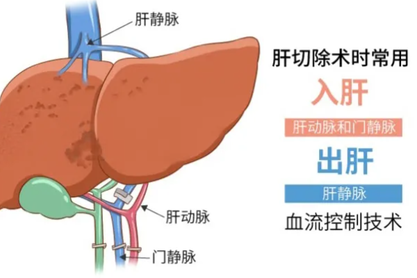 战胜肝癌的十大法宝（上）